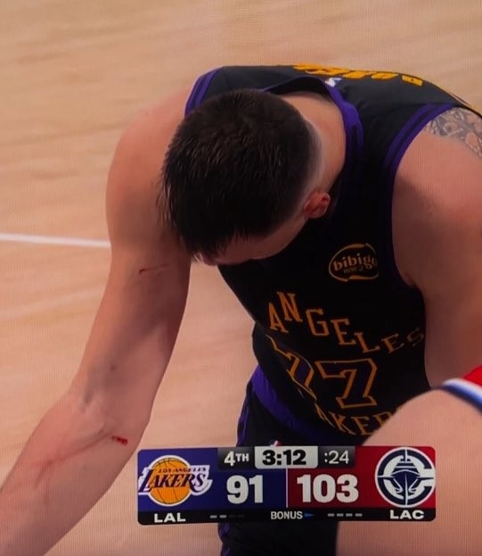 8868体育平台-谁抓的~东契奇罚球时看向手臂 好几道伤口&amp;血迹斑斑